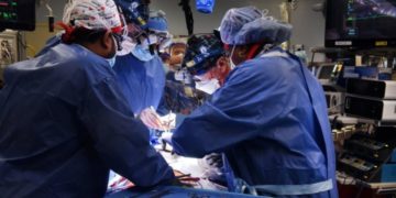 Trasplante de corazón